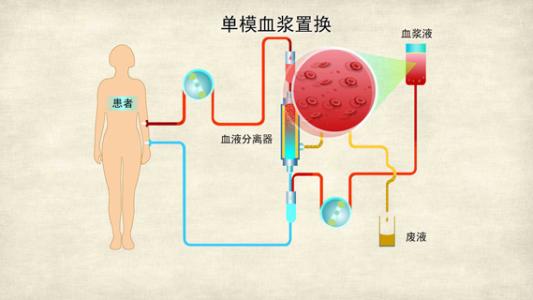 tpe醫(yī)學(xué)上是什么意思 tpe到底有幾種含義